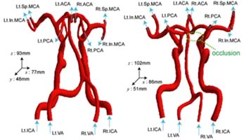 Modeling of Outflow Boundary Conditions Taking Acc
